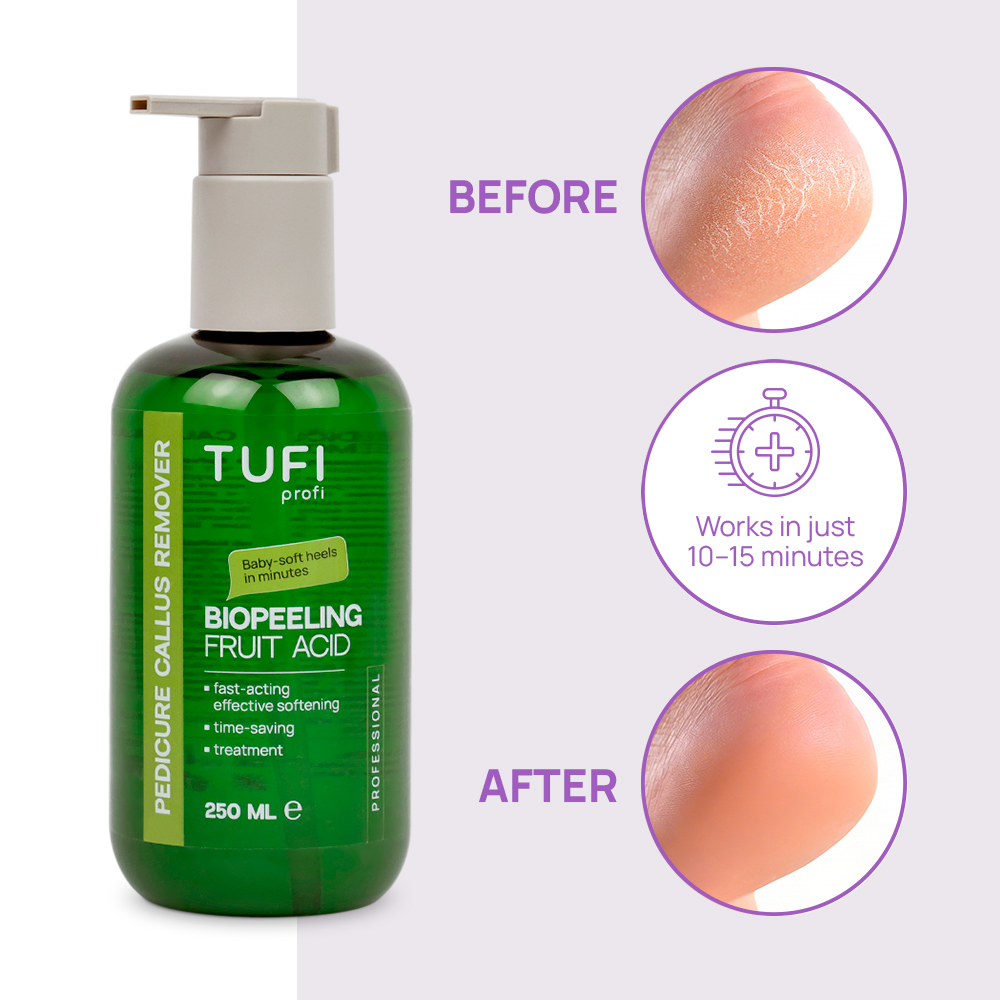 Ремувер для педикюру TUFI profi BioPeeling Fruit Acid для розм'якшення огрубілої шкіри стоп кислотний 250 мл, фото 2
