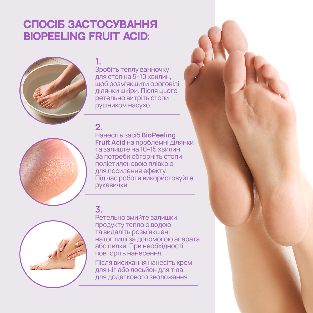 Ремувер для педикюру TUFI profi BioPeeling Fruit Acid для розм'якшення огрубілої шкіри стоп кислотний 250 мл, фото 3