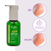 Ремувер для педикюра TUFI profi BioPeeling Fruit Acid для размягчения огрубевшей кожи стоп кислотный 100 мл, фото 4