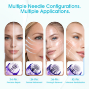 Картридж для микронидлинга Mast Microneedle 0.35 36P (1 шт), фото 4